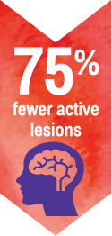 75% Reduction in Active Lesions
